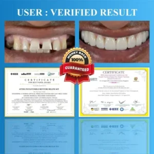 InstantSmile™ Denture Reline Kit