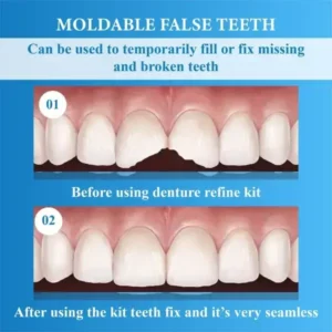 InstantSmile™ Denture Reline Kit