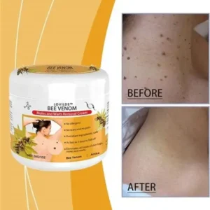 LOVILDS™ Bee Venom Mole and Wart Repair Cream