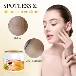 LOVILDS™ Bee Venom Mole and Wart Repair Cream