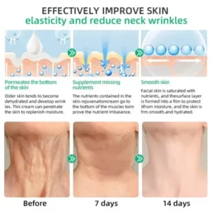 LOVILDS™ Wrinkle Removel Cream