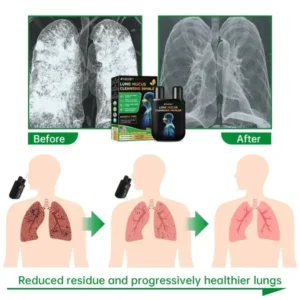 Raindew™ Lung Mucus Cleansing Inhaler