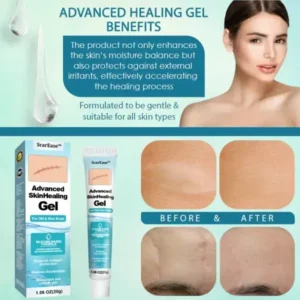 ScarEase™ Advanced SkinHealing Gel