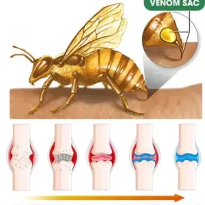 Seurico™ Bienenvenom Fortgeschrittene Gelenk- und Knochen-Therapiecreme