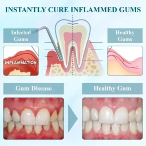 WhiteningSmile™ Coconut Oil GumGuard Mouthwash